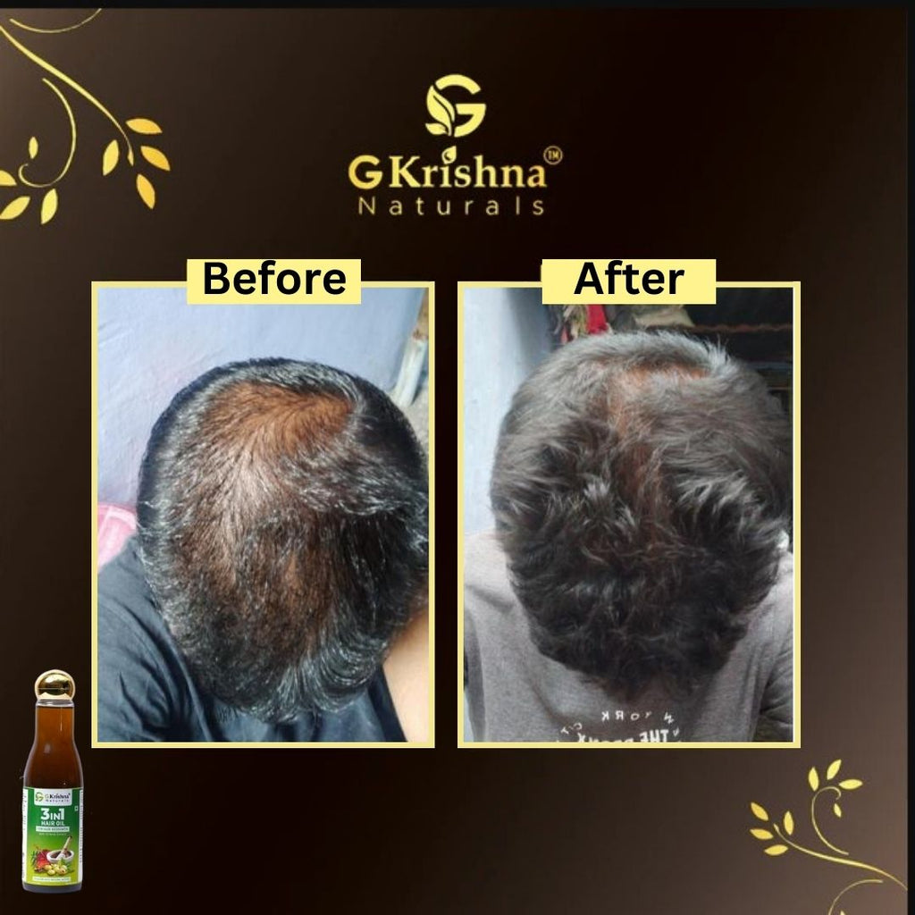 3 in 1 Herbal Hair Oil With 32 Herbs Extract for Hair Growth