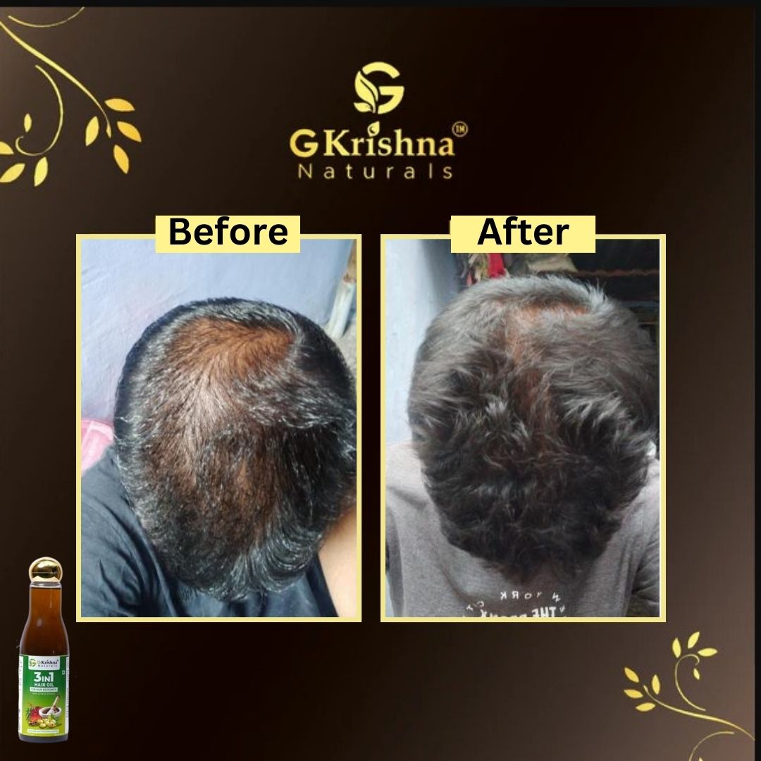 3 in 1 Herbal Hair Oil With 32 Herbs Extract for Hair Growth