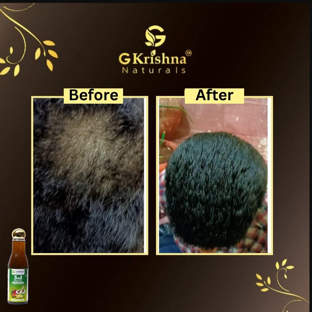3 in 1 Herbal Hair Oil With 32 Herbs Extract for Hair Growth