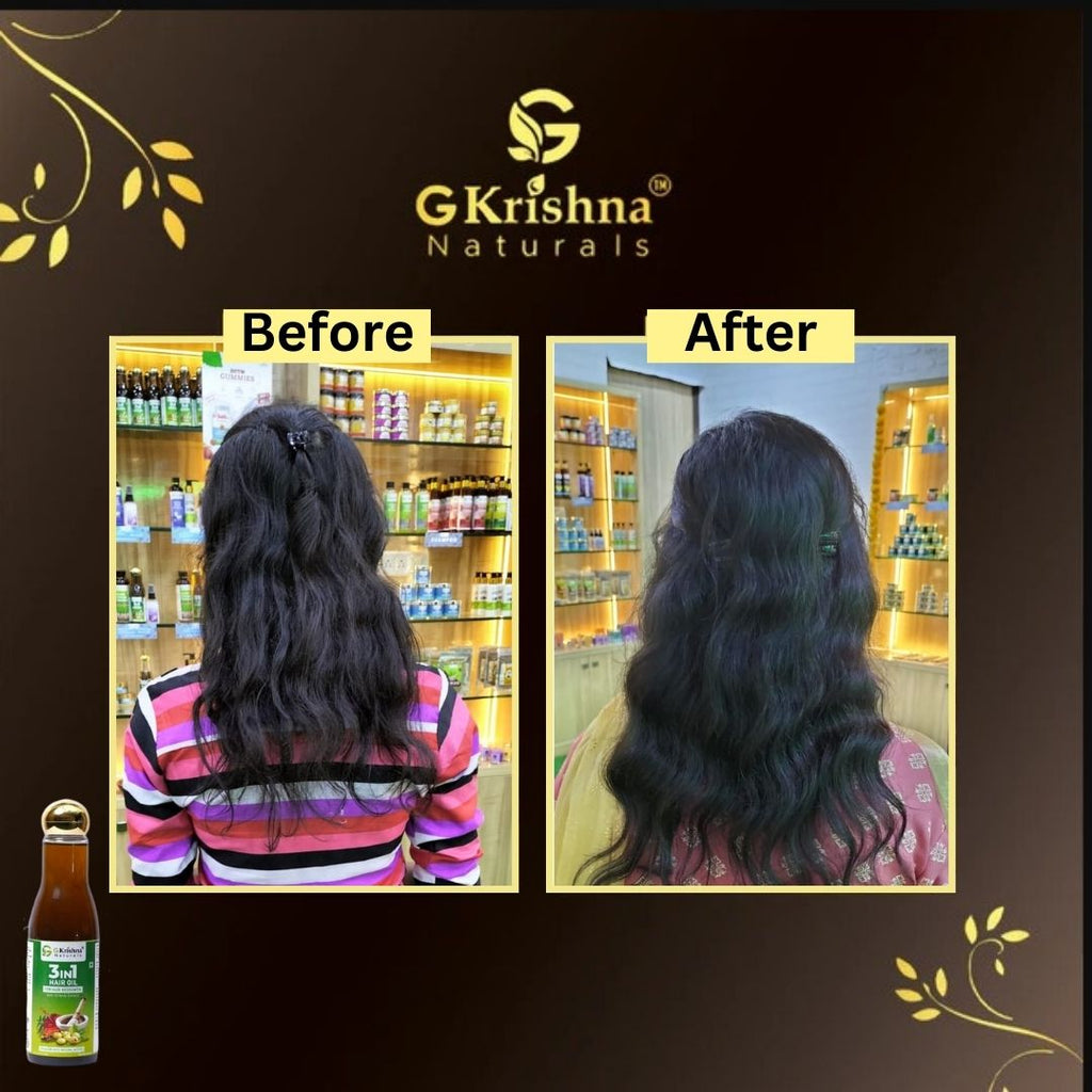 3 in 1 Herbal Hair Oil With 32 Herbs Extract for Hair Growth