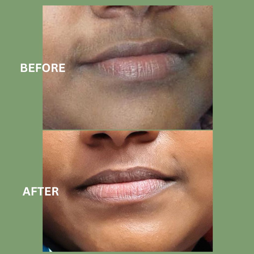 Facial Hair Prevention Powder