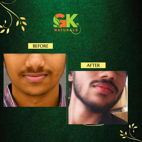 Beard Growth Oil for Men