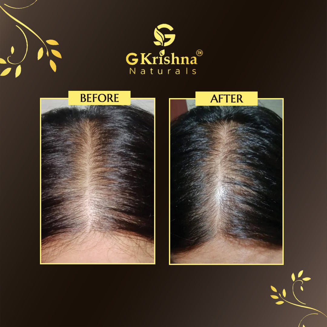 Hair Regrowth Kit for Men & Women