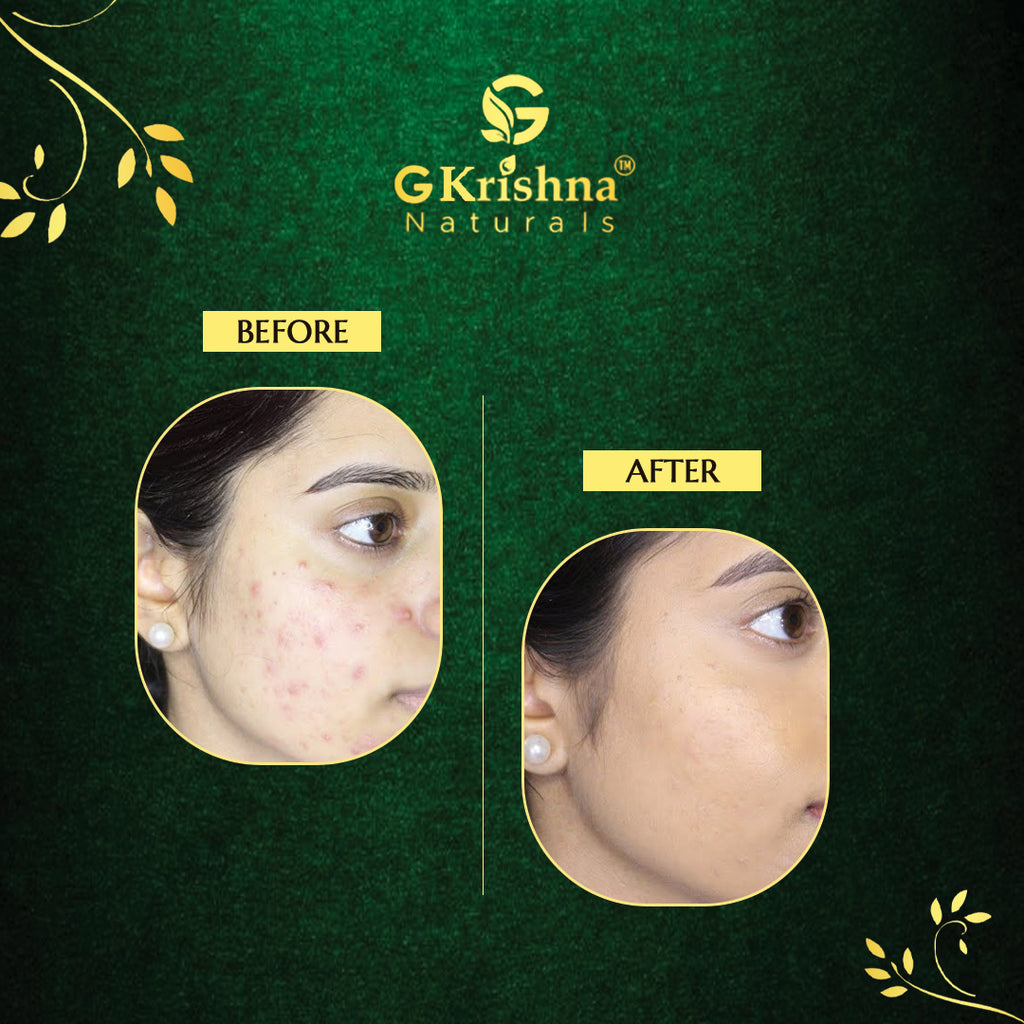 Neem face Wash