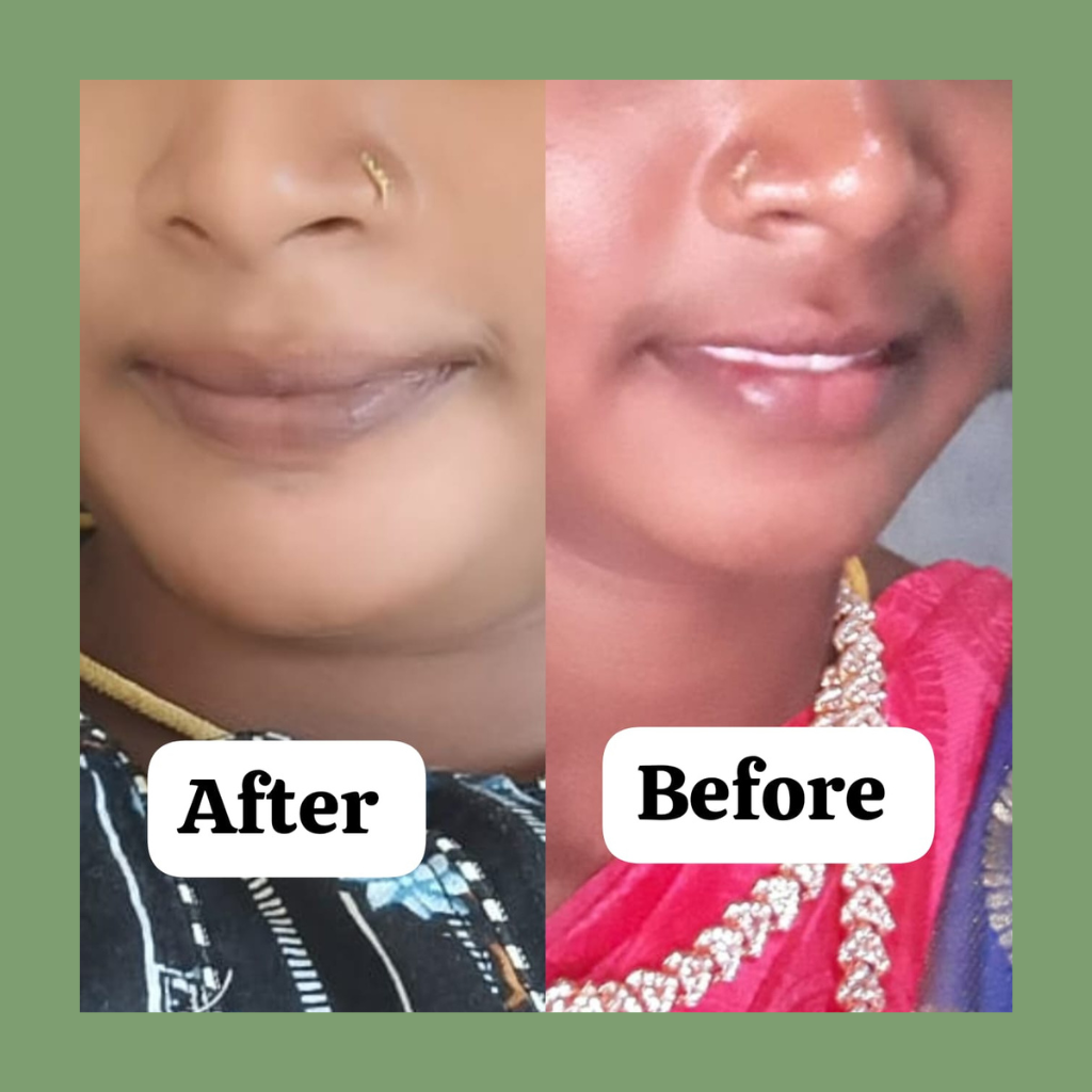 Facial Hair Prevention Powder