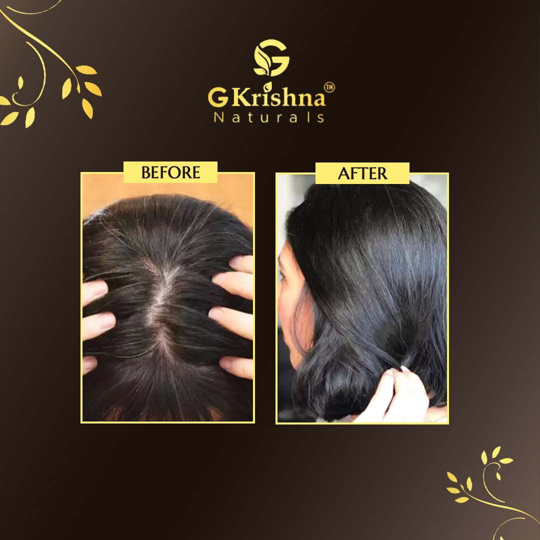 Pre-mature Grey Hair Kit